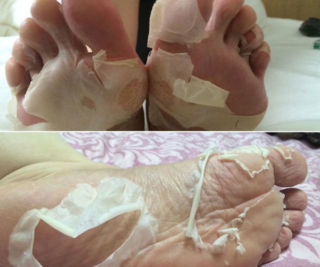 Deep Exfoliation Foot Peel