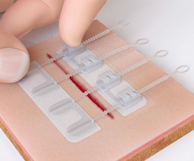 ZipStitch Laceration Kit