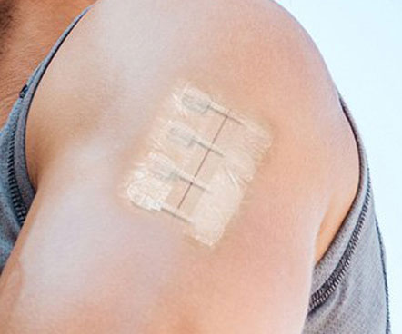 ZipStitch Laceration Kit