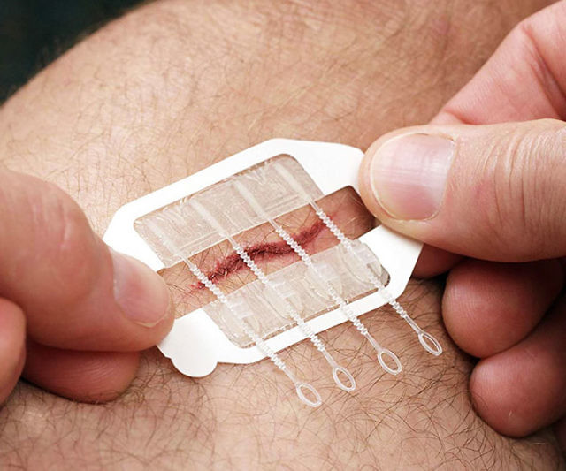 ZipStitch Laceration Kit